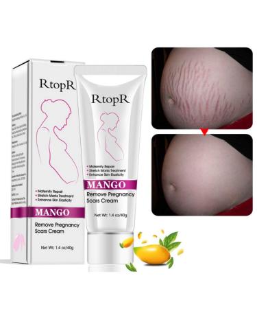 3pcs Scars Removal Cream Mango Remove Pregnancy Scars Cream Stretches Marks Treatment Maternity Repair Firming Skin