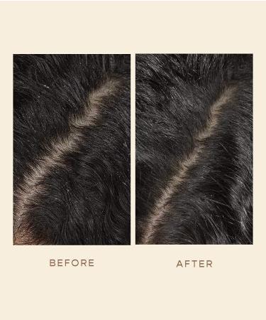 VEGAMOUR GRO Scalp Detoxifying Serum - Zinc PCA Removes Buildup Soothes Scalp Natural Citrus Scent 2 fl. oz. - International Shipping Available - Buy Online on GoSupps.com