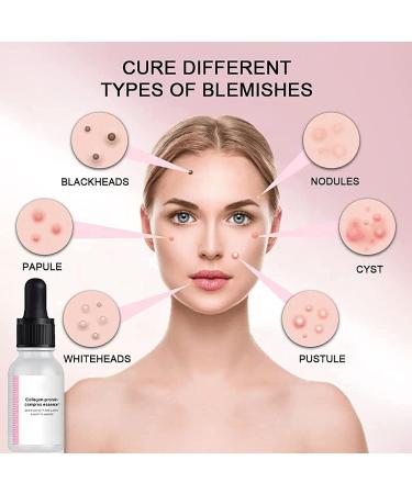 2022 New Blemishskin Corrector Serum Blemish Skin Corrector Serum Luxury 2022 New Sheep Placenta Collagen Serum Luxury Collagen Protein Complex Essence Serum Moisturizing Repair Serum (3PC) - Buy Online on GoSupps.com