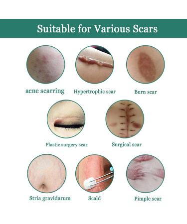Hotiary Plant Scar Repair Cream - Acne & Stretch Mark Remover for Scars, Burns, Postoperative Skin - Men & Women - Buy Online on GoSupps.com