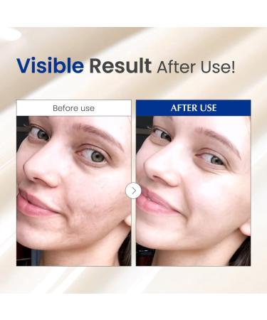 Dr. G Black Snail Retinol Ampoule - Korean Skincare with Snail Mucin - Advanced Retinol Face Ampoule for Glowing Skin - Anti Aging - Pore Minimizer for Fine Lines & Even Skin Tone Support - 1.69 fl oz - Buy Online on GoSupps.com