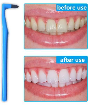 NITAIUN 5-Piece Teeth Stain Remover & Whitening Kit - Oral Hygiene Care Tool - Buy Online on GoSupps.com