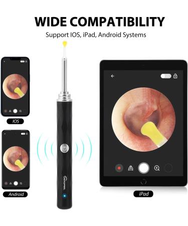 Ear Wax Removal Tool with 1296P Camera, 6 LED Lights & WiFi | Ear Cleaner Kit for iOS/Android - Black - Buy Online on GoSupps.com
