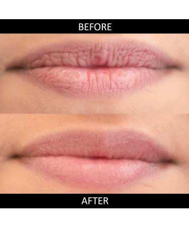 OMORFEE 100% Organic Hydrating Lip Stick for Dry & Chapped Lips - Nourishing Lip Butter for Cracked Lips - Moisturizes & Softens Very Dry Lips - 6g - Buy Online on GoSupps.com