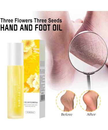Hand And Foot Essence Oil Foot And Hand Massage Oil Hand And Foot Oil Moisturizing Hand And Foot Cream For Smoother Skin Hand And Foot Oil Repairs Chapped Moisturizing On Hands And Feet - Buy Online on GoSupps.com