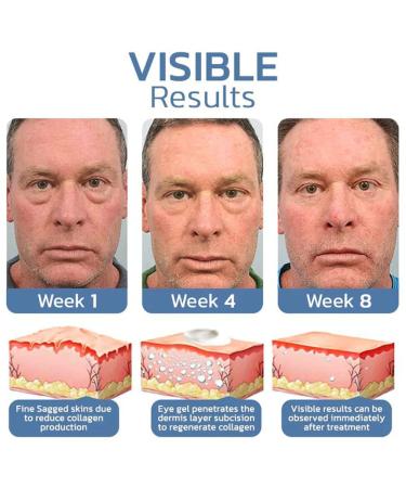 3Pcs Openeyes Gel Set - Awaken Peptide Lifting Eye Gel for Men & Women | Anti-Aging & Depuffing Eye Cream - Buy Online on GoSupps.com