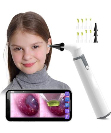 Buy Electric Ear Wax Removal Kit - Wireless Otoscope with 720P HD Camera & 6 LED for Kids & Adults - Buy Online on GoSupps.com