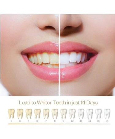 ST4U Teeth Whitening Pen - 1 Pcs Tooth Whitening Gel & Stain Remover for Oral Hygiene - Buy Online on GoSupps.com