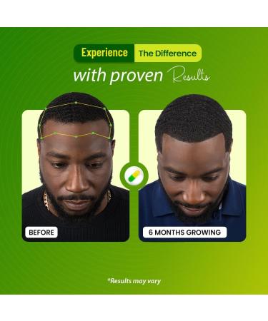 Rooted Strength Hair Growth Vitamins Hair Vitamins for Black Women & Men with DHT Blocker & Collagen Advanced Biotin for Hair Growth Women 60 Capsules 1-Month Supply for Thicker Stronger Hair - Buy Online on GoSupps.com