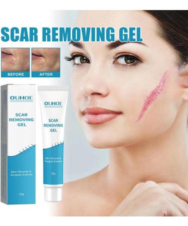 Waitlover Scar Removal Cream Gel - 20g | Repairs Pock Marks, Burns, Surgical Scars, Cesarean Scars & Stretch Marks | Moisturizes & Smoothens Skin - Care Mark Treatment - Buy Online on GoSupps.com