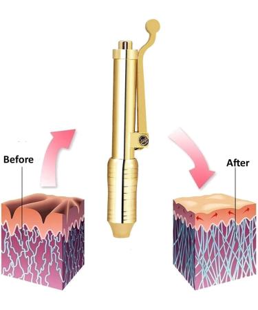 CZSBXBHD Hyaluronic Acid Pen Kit Hyaluron Micro Injector with 5 Ampoules Head Needle Free Injection Pen for Lifting Skin Lips Anti Aging Wrinkle Removal - Buy Online on GoSupps.com