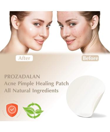 Spot Patch 216 Dots - Anti-stain Waterproof and Invisible - Absorbs water and oil prevents scars reduces bumps - Buy Online on GoSupps.com