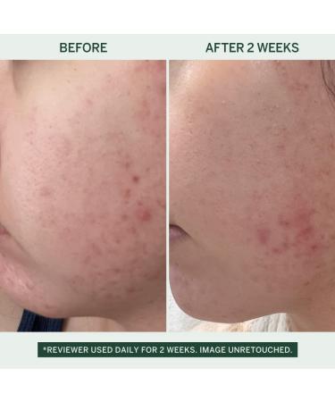 Urban Calm Hydrating Vita Serum | Glow Boosting Facial Serum with 10% Niacinamide & Fermented Mung Bean for Fine Lines & Wrinkles - Plump Revive & Soothe Dry Skin - 30ml - Buy Online on GoSupps.com