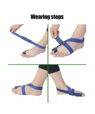 ANGGREK Hallux Valgus Strap - Bunion Corrector & Toe Separator for Foot Care - Buy Online on GoSupps.com