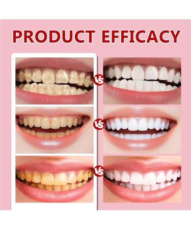 OIXYAZ OIXYA SP6 Whitening toothpaste contains probiotics to whiten and care for teeth thoroughly clean disinfect and freshen breath 100 g - Buy Online on GoSupps.com