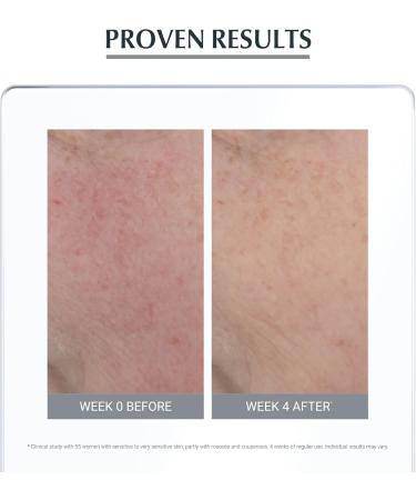 Eucerin Anti-Redness Concealing Day Cream - SPF25 50ml | Reduce Redness and Protect Skin - Buy Online on GoSupps.com