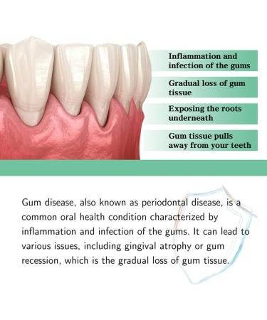 Dentizen Gingival Rejuvenation Drops - Natural Gum Repair for Receding Gums | 3 Pack | Effective Oral Care Solution - Buy Online on GoSupps.com
