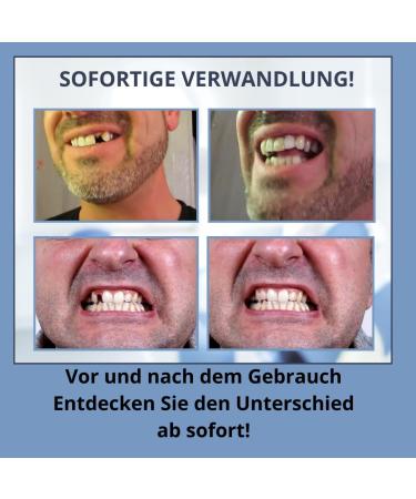 Dentimed Temporary Dentures | Provisional Tooth Repair Set | Cosmetic Dental Prostheses for International Shipping - Buy Online on GoSupps.com