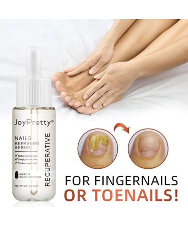 Lurrose Nail Repairing Serum 20ml - Onychomycosis Softening Solution for Discolored Nails - Nails Treatment Oil for Damaged Nails - Buy Online on GoSupps.com