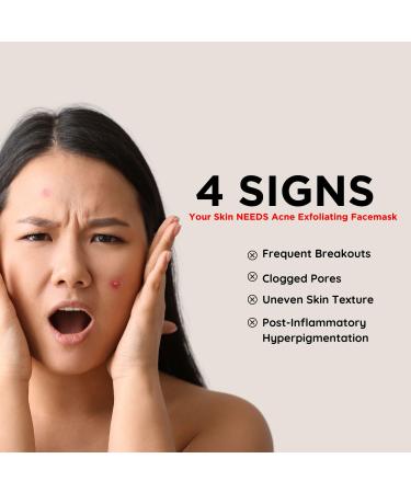 Revive Exfoliating Acne Face Mask & Scrub - 3.4 fl.oz | 2% Salicylic Acid & Aloe Vera for Oily Combination Skin - Treat Acne Prone Skin International Shipping - Buy Online on GoSupps.com