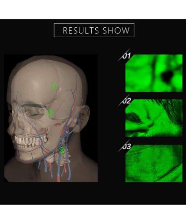Adjustable Vein Viewers for Nurses | USB Camera Imaging IV for Accurate Venous Access | Ideal for Adults | Enhance Vein Puncture Success - Buy Online on GoSupps.com