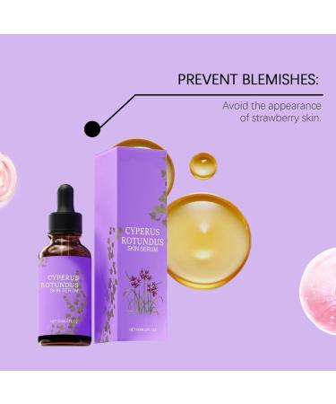 S rum Sur La Peau Du Rotonde 60 Ml D'huile De Cyperus Rotundus Pour L' pilation Une Solution D' pilation Efficace De L'huile De Cyberglow Douce Naturelle (2) - Buy Online on GoSupps.com