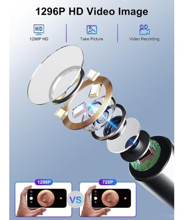 Wireless 1296P HD Ear Wax Removal Tool with Camera and LED Lights - Waterproof Otoscope for iPhone & Android - Black - Buy Online on GoSupps.com