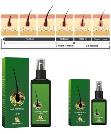 Hair Growth Serum Hair Lotion Hair Loss Treatments for Men Women Promotes Hair Thicker and Stronger Natural Nourishing Hair Growth Spray Hair Care for Dry Damaged Hair. (120ml) - Buy Online on GoSupps.com