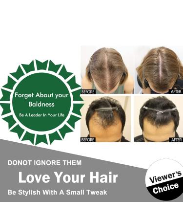 Hair Growth Serum - Natural Hair Loss Treatment & Stimulates New Growth (30ml) | International Shipping - Buy Online on GoSupps.com