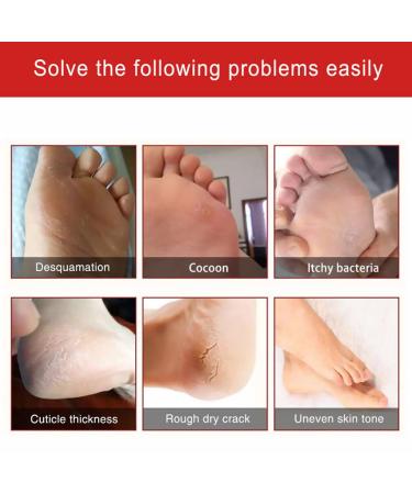 2ST Foot Cream - Moisturizing Peeling Butter for Dead Skin | Best Foot Care Lotion & Accessories - Buy Online on GoSupps.com
