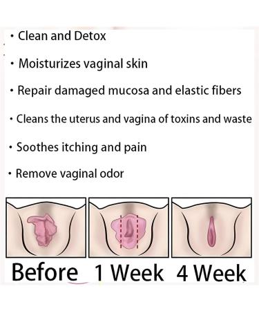 Natural Repair Capsules Natural Repair Vagianal Capsules Natural Repair Vajinal Capsules Firming Repair & Pink and Tender Natural Capsules Stay Clear & Fresh (3BAG) - Buy Online on GoSupps.com