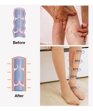 Buy 2 Pairs Medical Compression Stockings 20-30 mmHg for Men & Women Class 2 Closed Toe Support for Varicose Veins & Edema XL 2X Beige International Shipping - Buy Online on GoSupps.com
