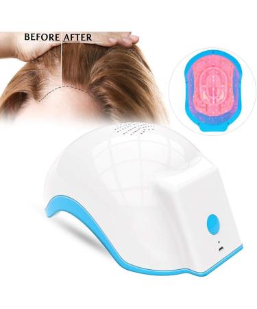 Casque De Traitement pour La Repousse des Cheveux Chapeau De Th rapie Contre La Perte De Cheveux avec 62 Points D'irradiation LED Couvrant Tout Le Cuir Chevelu R gule La S cr tion D'huile - Buy Online on GoSupps.com