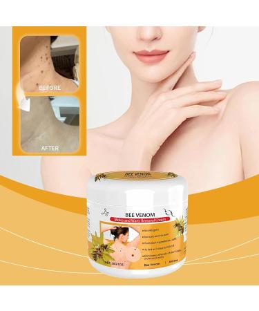 30ml Bee Venom Ointment & Cream - Moisturizing for All Skin Types | Natural Wart Removal & Rejuvenating Care for Men & Women - Buy Online on GoSupps.com