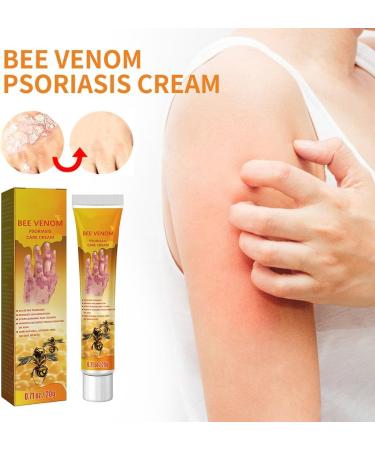 HePbAK Youth Bee Venom Psoriasis Treatment Cream | Professional Soothing Moisturizer for All Skin Types | 3PCS - Buy Online on GoSupps.com