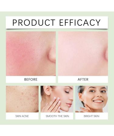 Gentle Hydrating Toner - Moisturizing & Refreshing Facial Essence Water For Daily Toning/Wiping Balances Oil Reduces Redness Leaves Skin Soft & Glowy(3PCS) - Buy Online on GoSupps.com