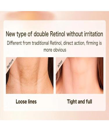 New Dual Retinol Anti-Wrinkle Neck Cream Retinol Anti-Aging Neck Cream Moisturizing Neck Cream Collagen Lifting and Firming Neck Cream Moisturizer - Buy Online on GoSupps.com