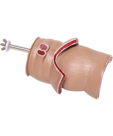 Anatomy Model: Human Rectal Lesion Fistula & Fissure Pathology - Ideal for Teaching | International Shipping - Buy Online on GoSupps.com