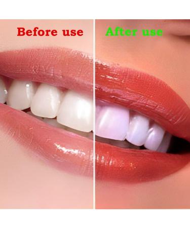 Realistic Upper and Lower Veneer Cosmetic Teeth Set for Confident Smile - 4 PCS Fake Teeth for Men and Women with Comfortable Fit - Buy Online on GoSupps.com
