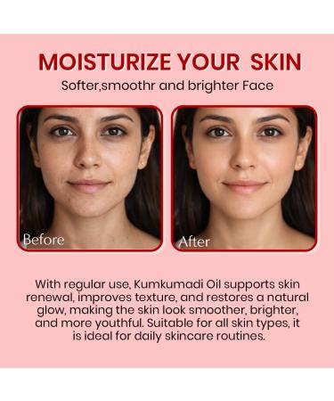 Bio Mystery Authentic Kumkumadi Elixir Oil Rodiont Brighter Face Oil For Glowing Skin Dark Spot Wrinkles and Pigmentation | Rich in Vitamin A & C | 30ml/1 floz - Buy Online on GoSupps.com