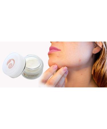  Snail Green Snail Green Face Acne Cream enriched with Rosemary Burdock Orange and Thyme Extracts. Purifying Blackhead-Reducing Anti-Blemish. Made in Italy. 50 ml - Buy Online on GoSupps.com