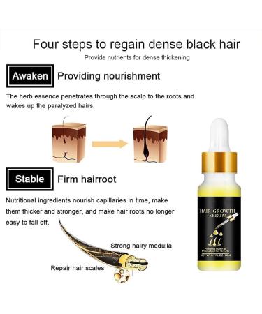 Tress Diary Hair Growth Oil for Black Women and Men Essential Oil for Hair Growth - Buy Online on GoSupps.com