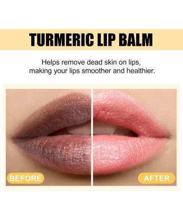 Lip Lightener For Dark Lips Turmeric Lip Balm Lightening Cream For Pink Lips To Soften And Moisturize Lips Turmeric Restoration Treatment (1) - Buy Online on GoSupps.com