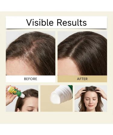 S rum de croissance des cheveux au gingembre de 7 jours s rum nourrissant pour le cuir chevelu pour les cheveux clairsem s traitement paississant pour les cheveux les plus volumineux. (8PCS) - Buy Online on GoSupps.com