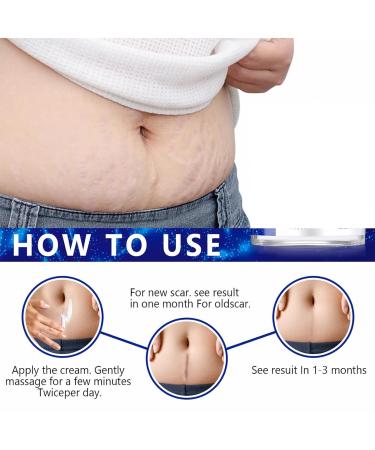 Advanced Scar Gel for Surgical Acne & Keloid Scars - Effective Scar Removal for Face & Body - 100% New - 2 Bottles - Buy Online on GoSupps.com
