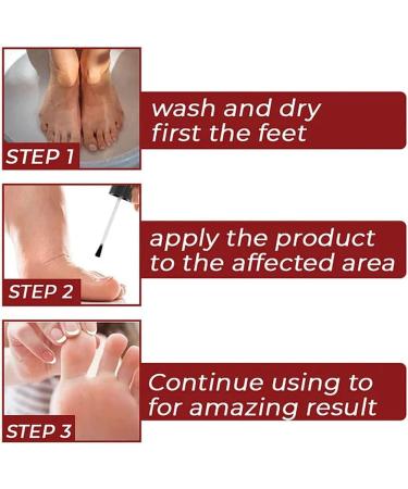 Footpro Extra Strength Corn Removal Gel 10ml - Set of 2 | Foot Corn Remover for Feet - Buy Online on GoSupps.com