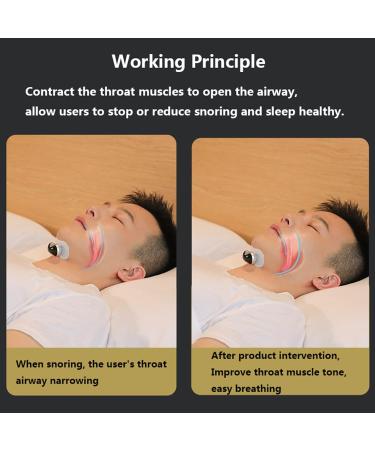 Smart Electric Anti Snoring Stopper with Variable Speed - Portable Laryngeal Device for Improved Nighttime Sleeping - Buy Online on GoSupps.com