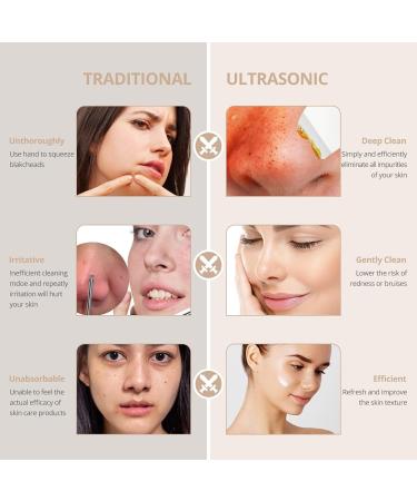 Hotsch Skin Scrubber Face Spatula - Ultrasonic Blackhead Remover and Pore Cleaner with 3 Modes - Rechargeable Facial Cleansing Tool - Buy Online on GoSupps.com