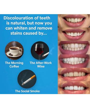 Peroxide-Free Pap+ Teeth Whitening 42 Strips - Professional Teeth Whitening Strips for Sensitive Teeth - Gentle on Veneers - Easy 30-Minute Application - Natural Non-Peroxide Formula - Buy Online on GoSupps.com