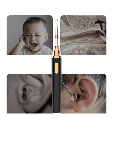 SHILONG Ear Wax Removal Tool with Camera - Earwax Removal Kit for iOS & Android - Buy Online on GoSupps.com